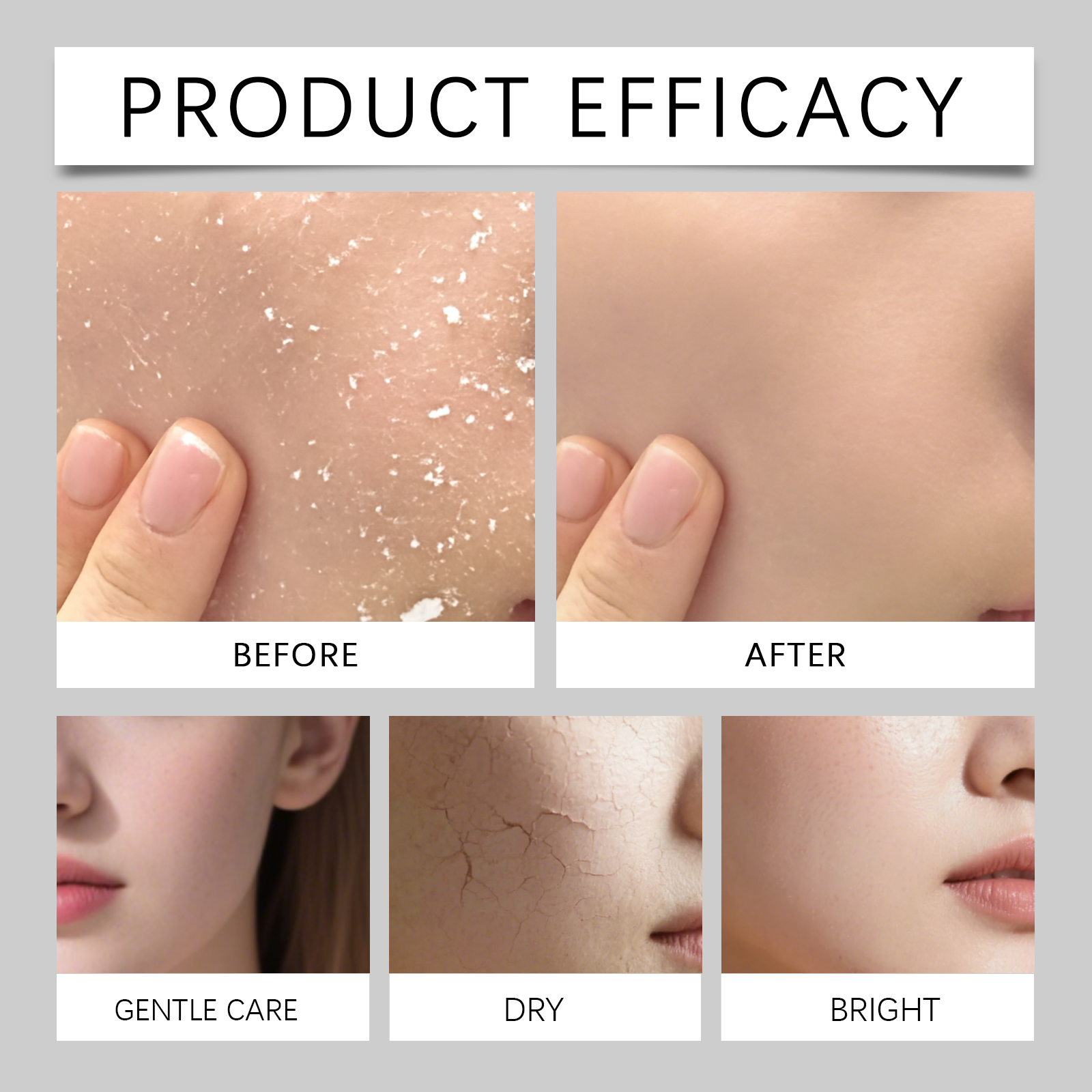 80ml Hydrating Mist for Anti D - Luxury Natural Skincare 리뷰 및 가격
